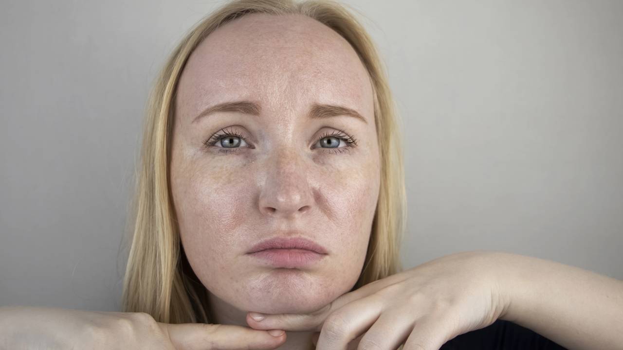 Catequinas: As Guardiãs do Seu Rosto contra o Inchaço - inspiração 2