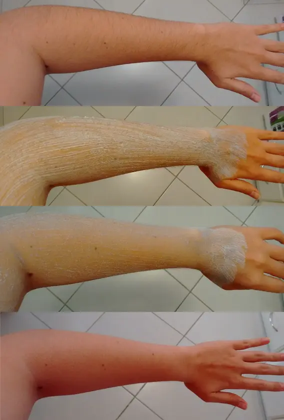 O Processo de Clareamento: Um Guia Passo a Passo Detalhado - inspiração 1