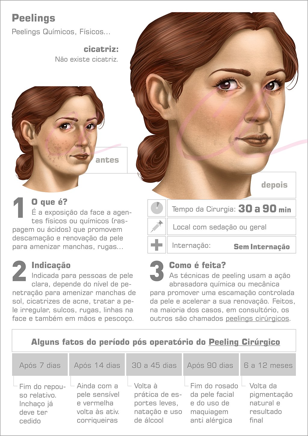 Esfoliação Controlada: Removendo Células Mortas com Segurança - inspiração 1