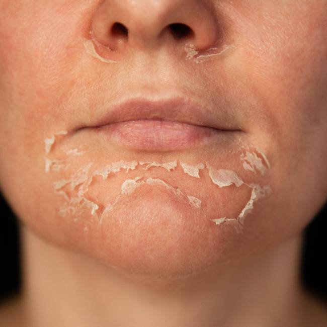 Evite Certos Produtos: Interações a Serem Evitadas - inspiração 2