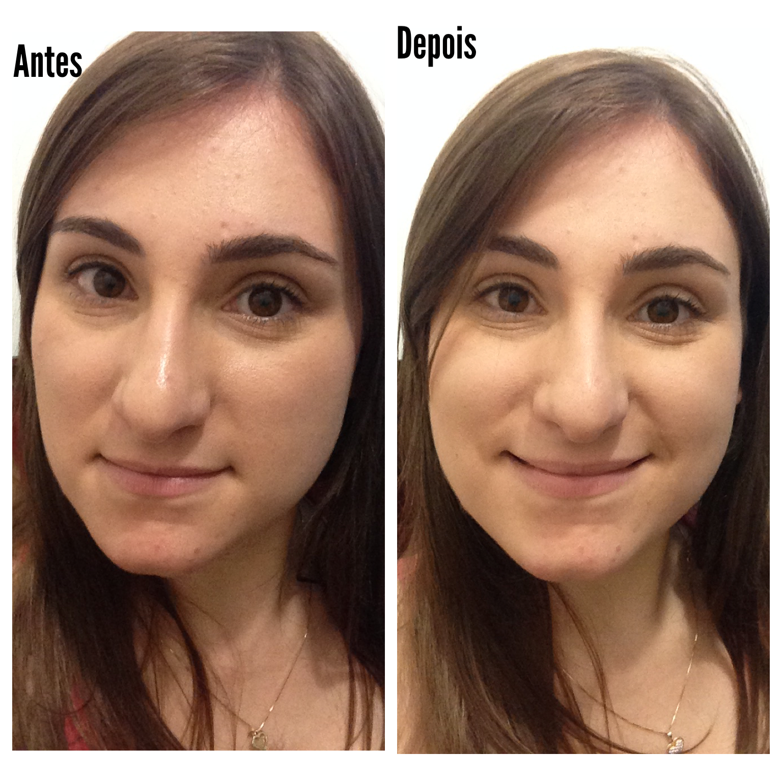 A Importância da Hidratação, Mesmo com Pele Oleosa - inspiração 1