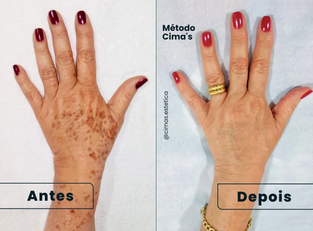 A Ciência por Trás das Manchas e Por Que Elas Aparecem - inspiração 2