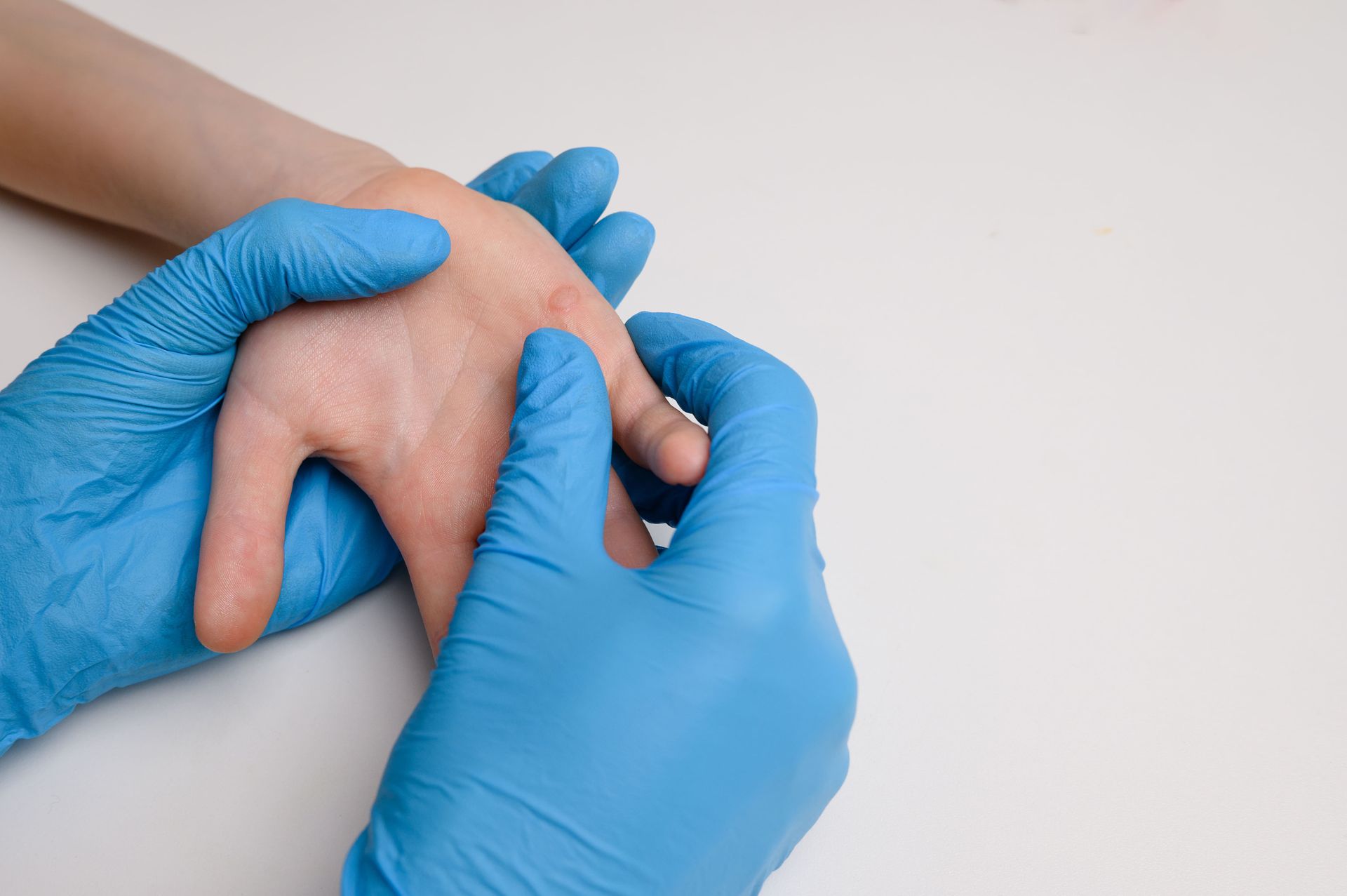 Prevenção é a Chave: Cuidados Contínuos para Evitar Novas Manchas - inspiração 2