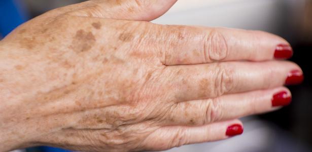 O Papel Essencial da Proteção Solar Diária (Sim, nas Mãos!) - inspiração 2