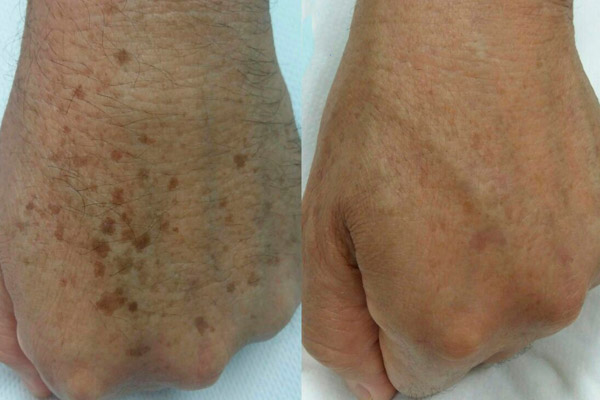 Hidratação Profunda: Um Passo Fundamental para a Regeneração da Pele - inspiração 2