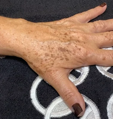 Clareadores que Você Pode Usar em Casa: Ingredientes a Procurar - inspiração 1