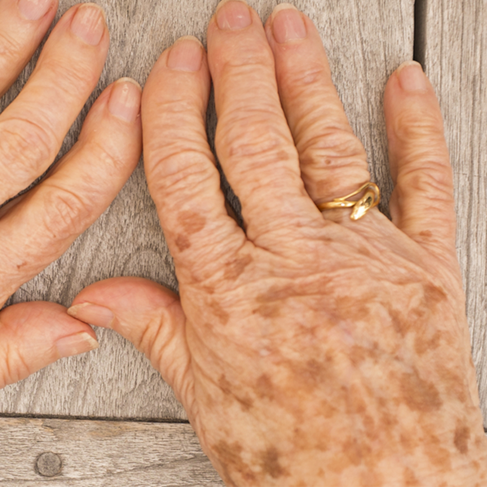 Clareadores que Você Pode Usar em Casa: Ingredientes a Procurar - inspiração 2