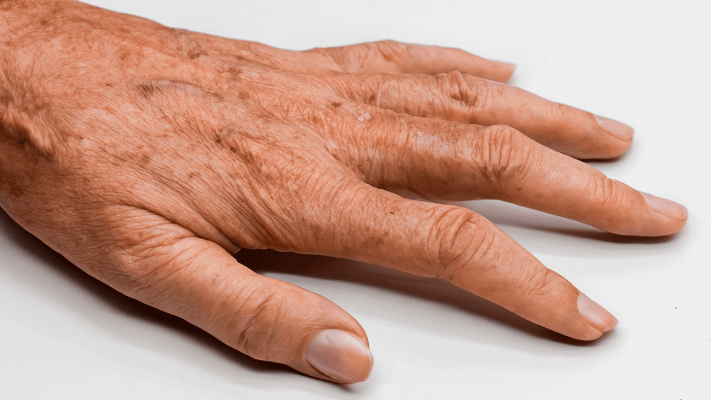 O Poder dos Peelings Químicos Suaves e suas Vantagens - inspiração 2