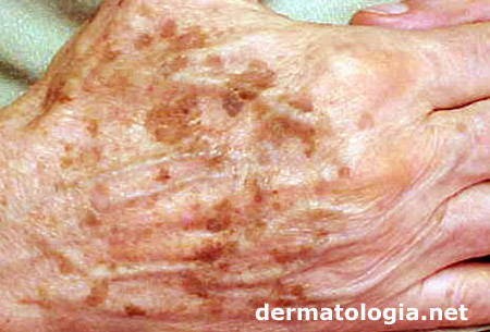 Tratamentos a Laser e Luz Pulsada: Soluções Mais Intensivas - inspiração 1