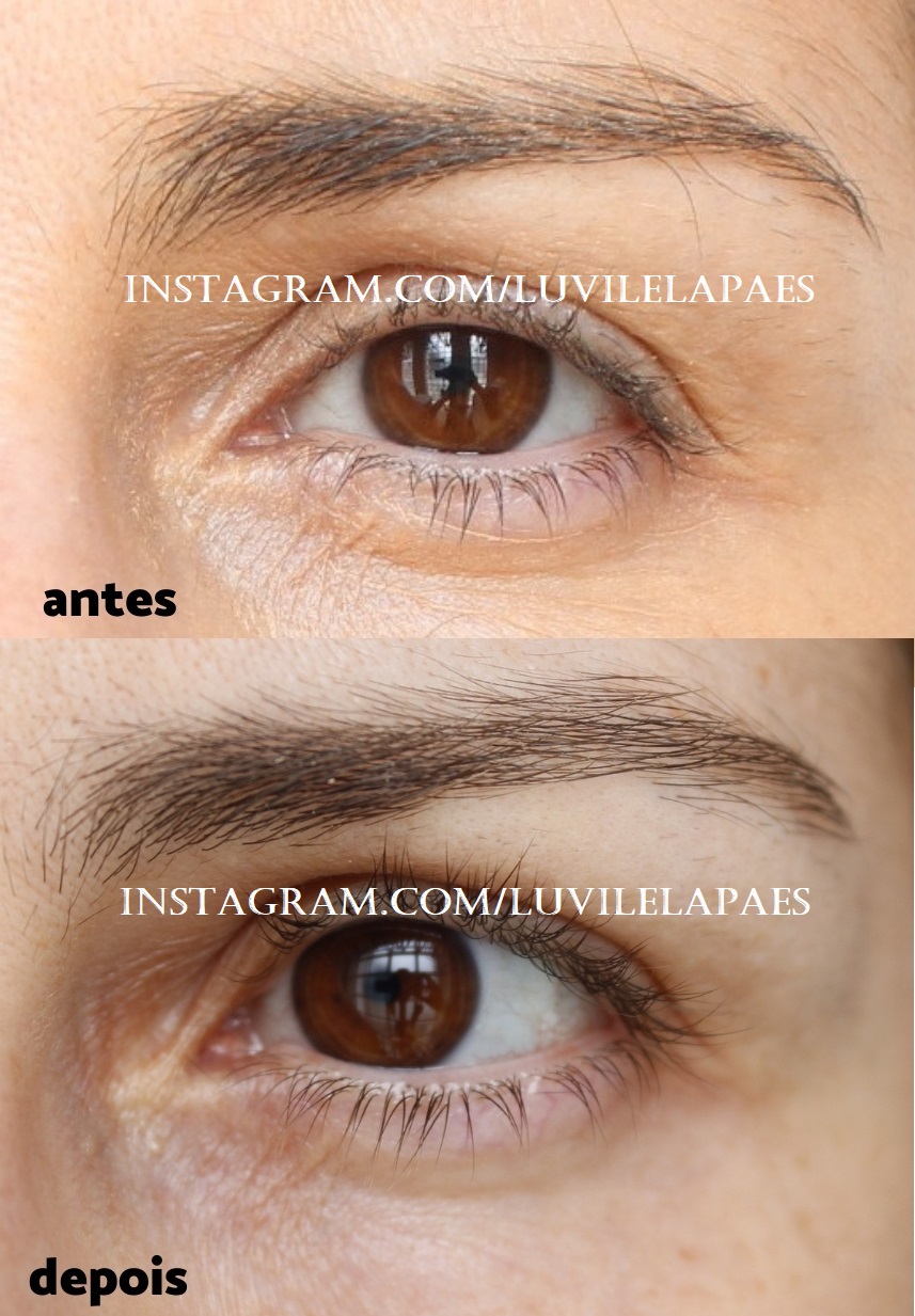 A Importância da Consistência: Como Integrar o Sérum na Sua Rotina Diária - inspiração 2