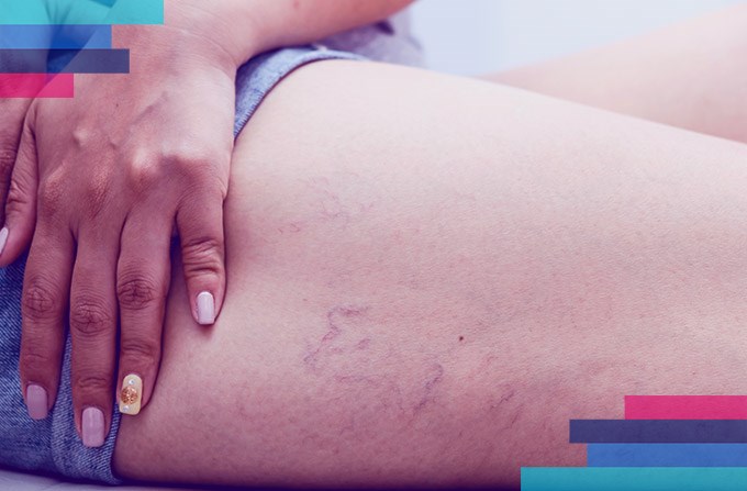 Ao Chegar: Continue Cuidando do Seu Corpo Pós-Voo - inspiração 1