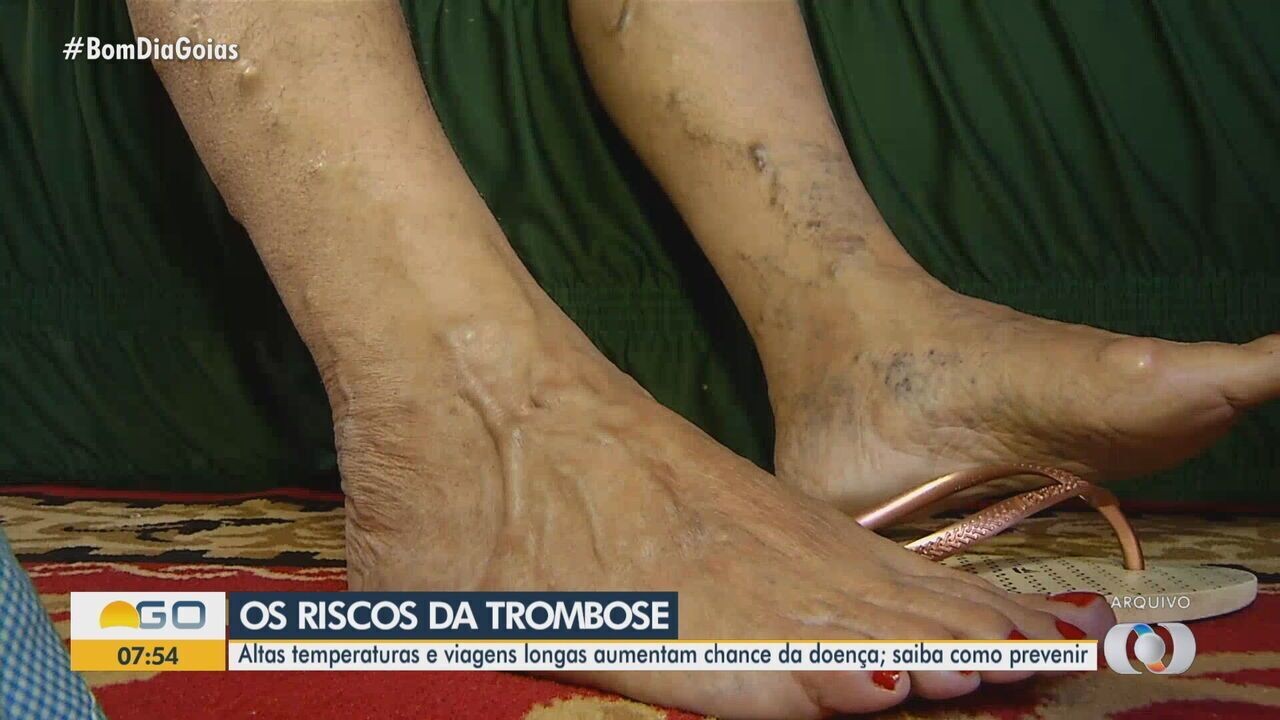 Ao Chegar: Continue Cuidando do Seu Corpo Pós-Voo - inspiração 2