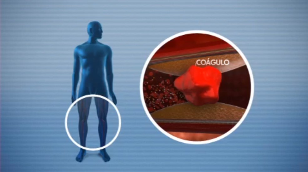 Alimentação Leve: Menos Inchaço, Mais Bem-Estar - inspiração 1