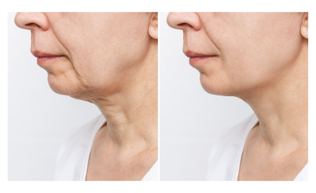 Hidratação: Essencial para a Elasticidade - inspiração 1