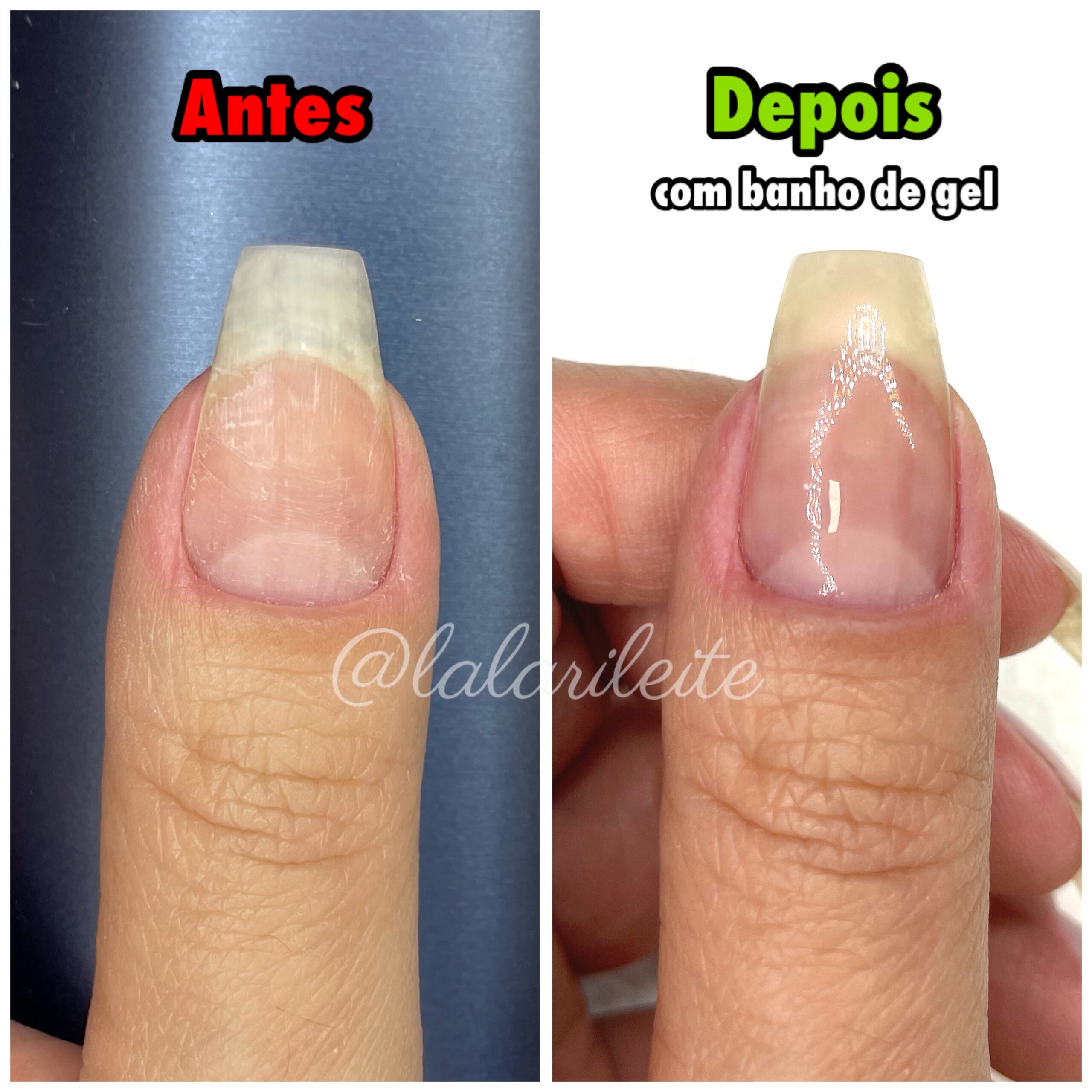 fortalecimento de unhas
