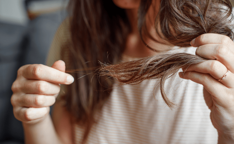 melhores vitaminas para queda de cabelo feminino