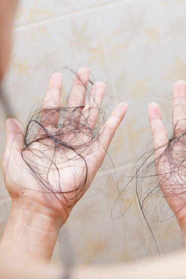 erros comuns ao tratar queda de cabelo em mulheres