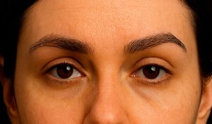 correção de falhas na sobrancelha natural