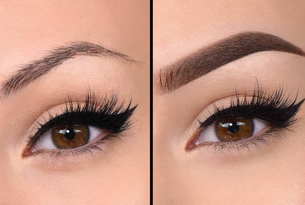 correção de falhas na sobrancelha natural