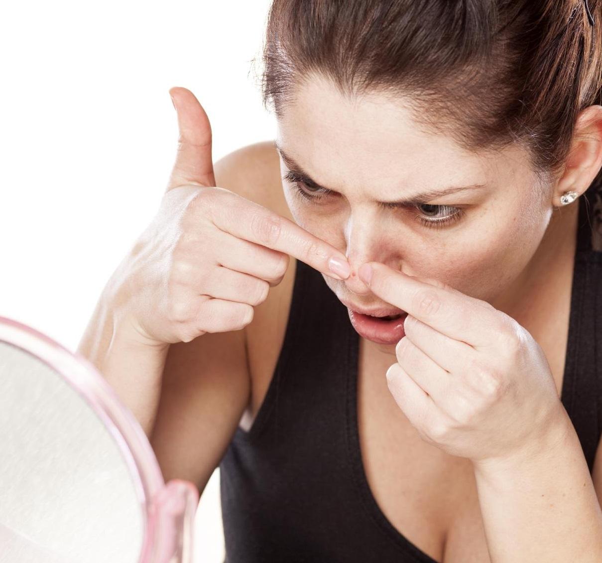 melhor método para tirar cravos em casa