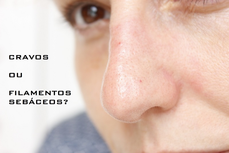 rotina de skincare para pele com cravos
