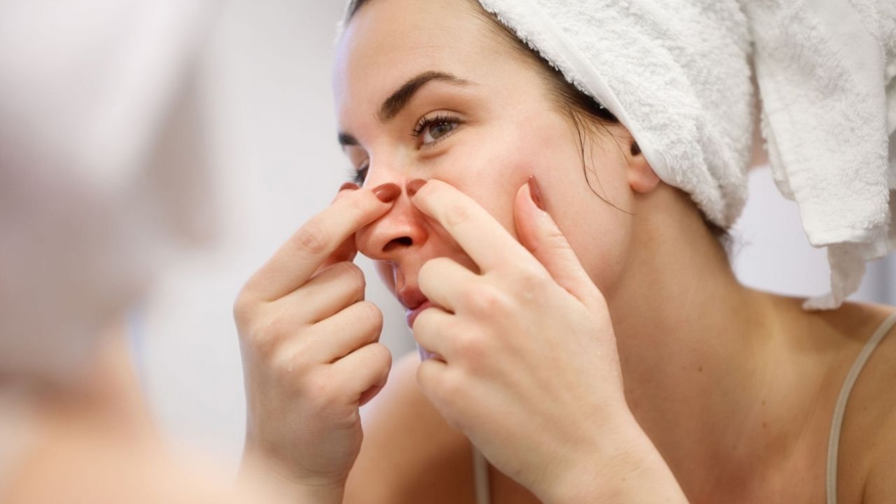 melhores tratamentos para cravos resistentes