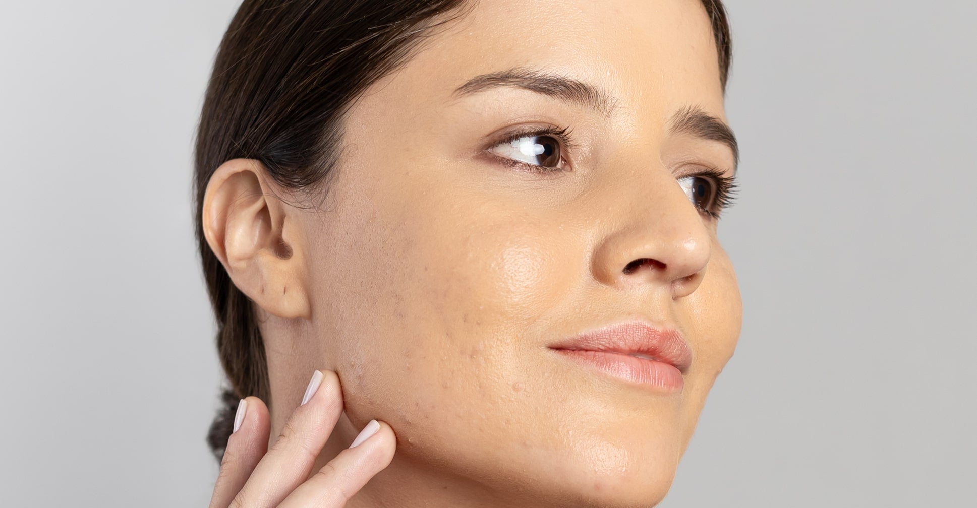 Como tratar cravos pretos persistentes no queixo