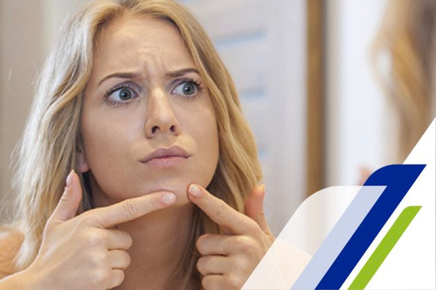 melhores tratamentos para cravos resistentes