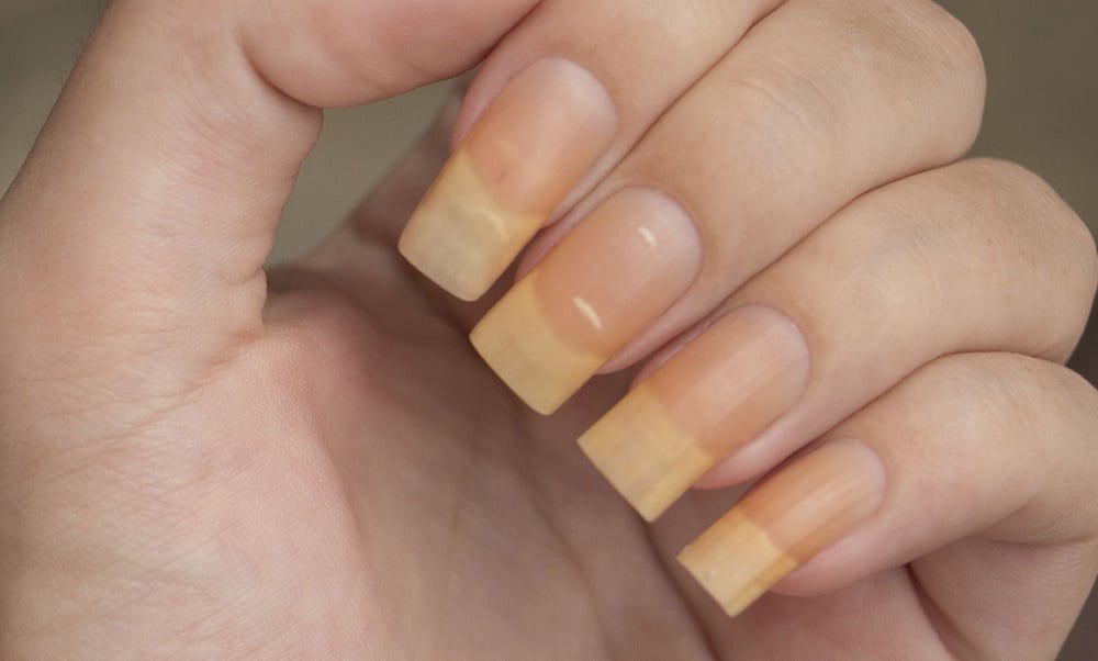Como tratar unhas amareladas por causa de esmalte