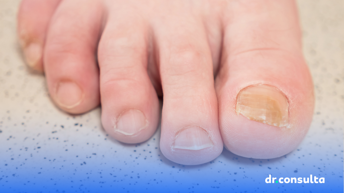 Base Desamareladora: O Segredo para Proteger Suas Unhas de Esmaltes Escuros