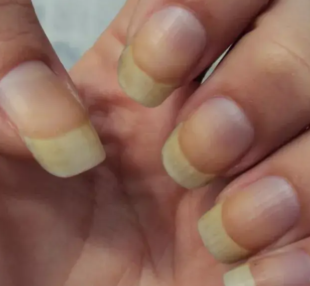 Guia Completo de Cuidados para Evitar Unhas Amareladas pelo Esmalte