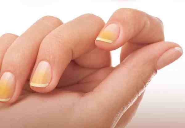 Base Desamareladora: O Segredo para Proteger Suas Unhas de Esmaltes Escuros