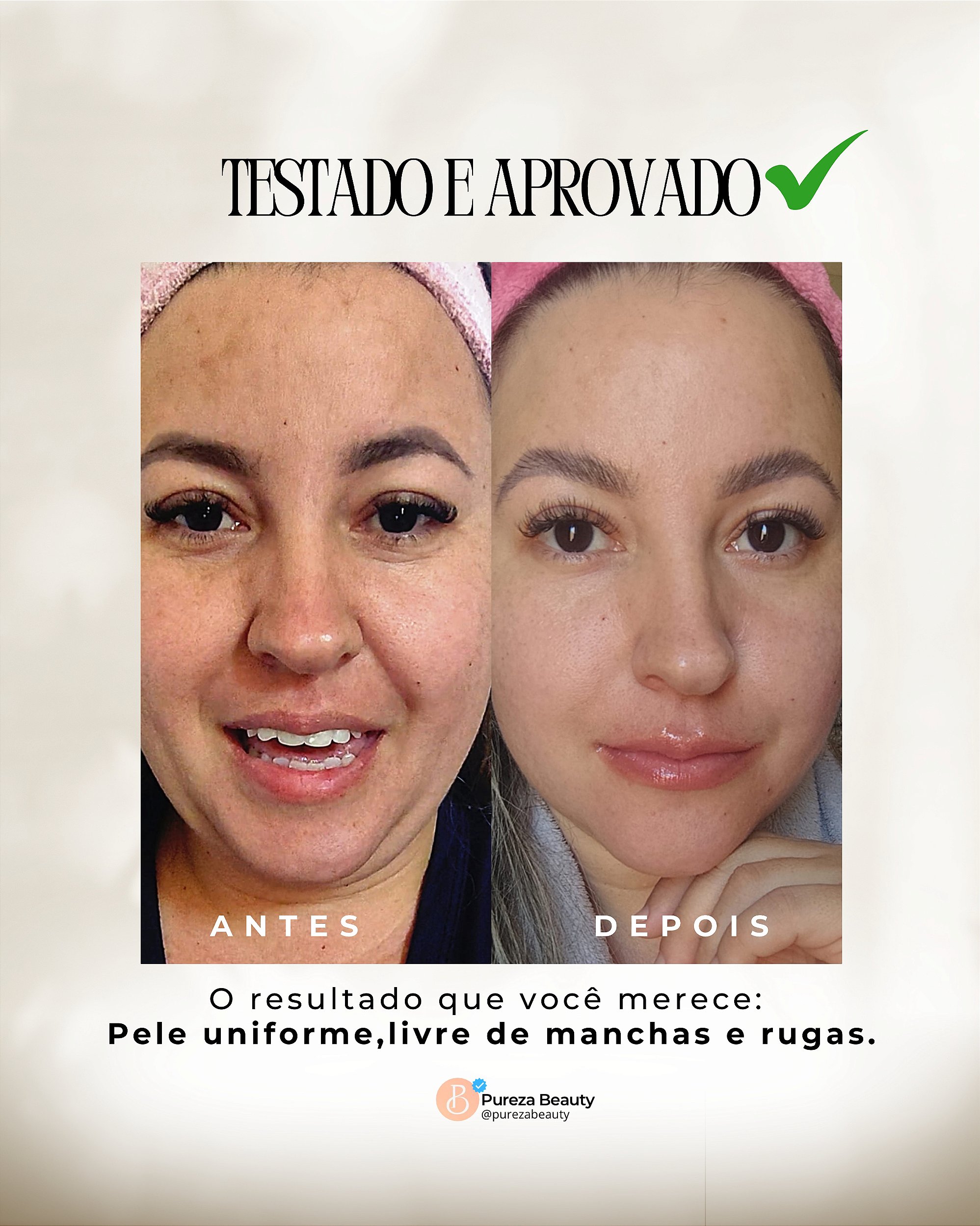 Vitamina C e Ácido Hialurônico: A dupla perfeita para peles jovens