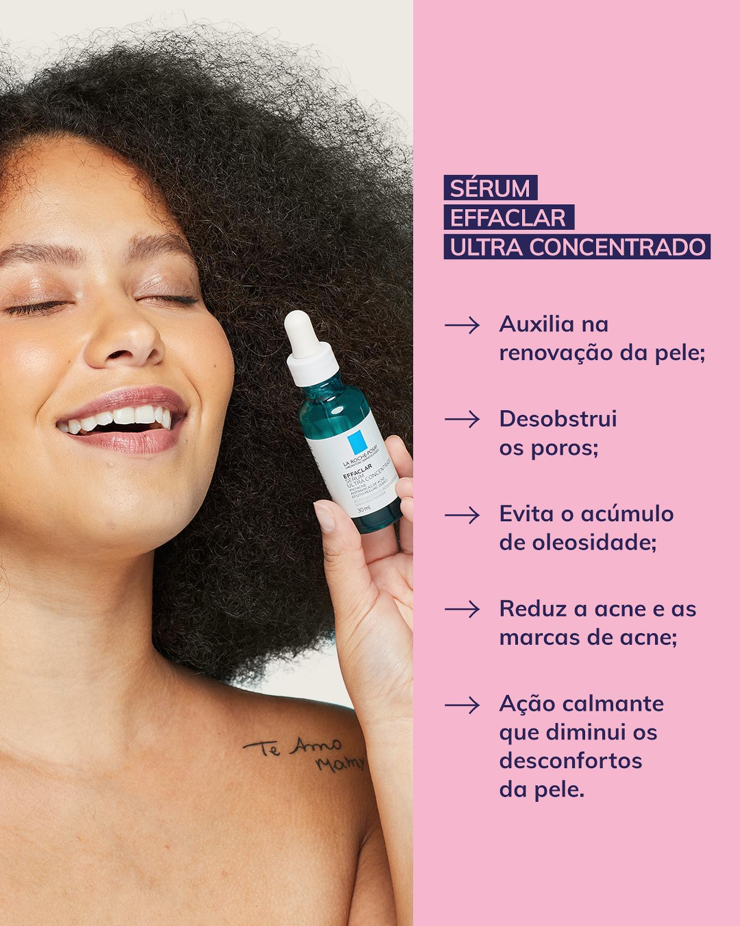 tratamento de acne com ácidos