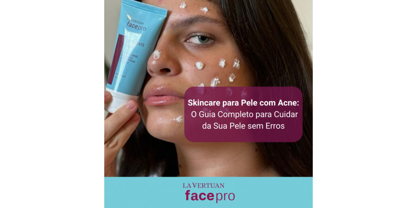 tratamento de acne com ácidos
