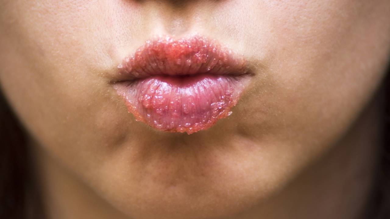 Como Escolher o Melhor Esfoliante Labial para o Seu Tipo de Pele