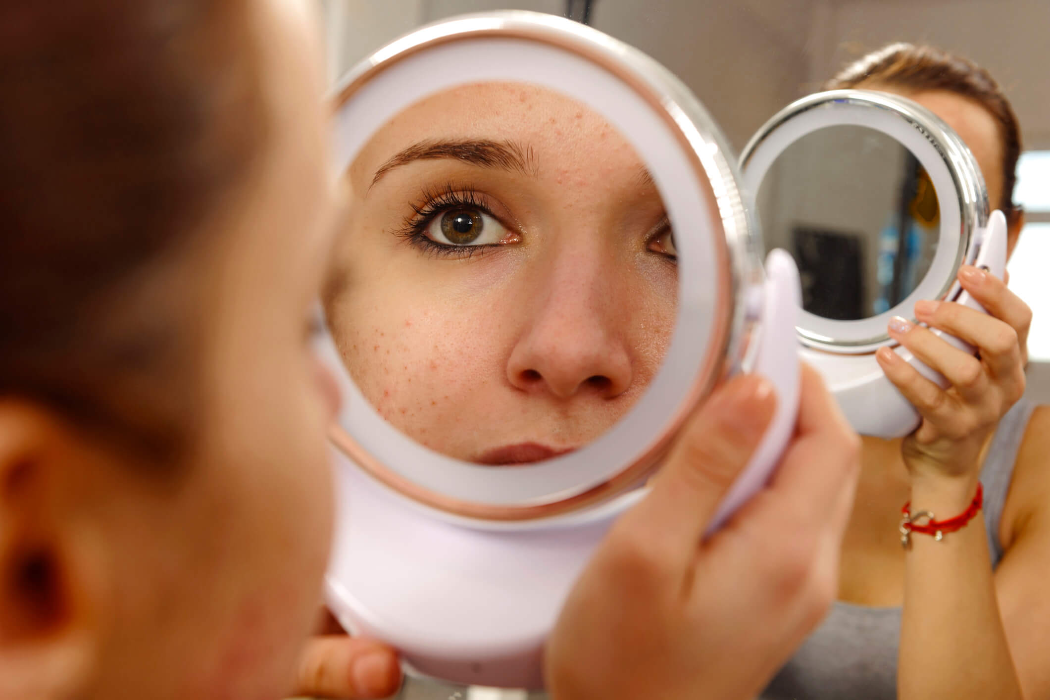 maquiagem para disfarçar vermelhidão rosácea