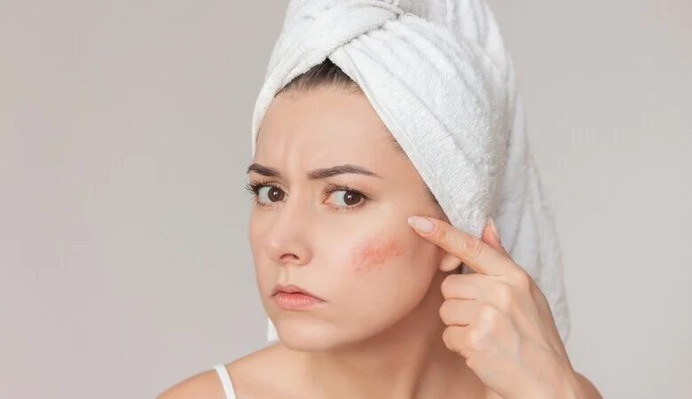 melhores bases para pele sensível com rosácea