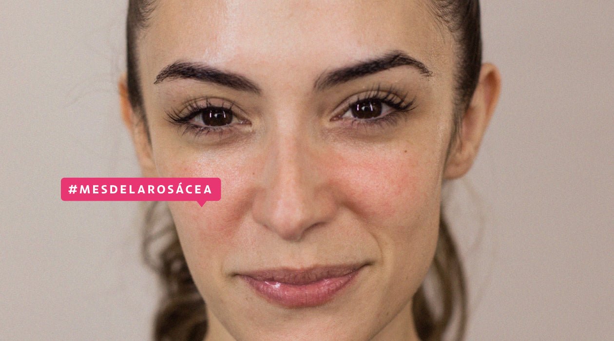 como maquiar pele com rosácea