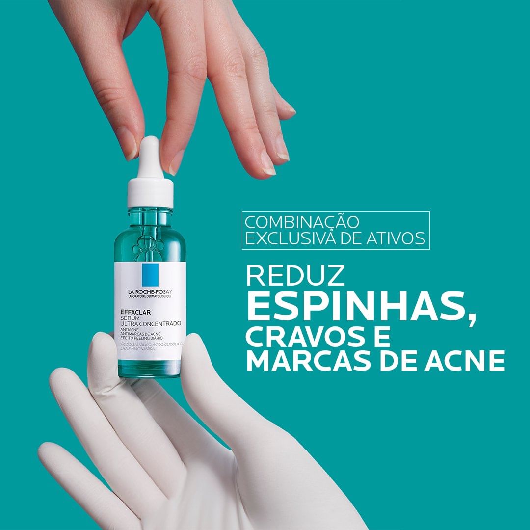melhores ácidos para acne e manchas