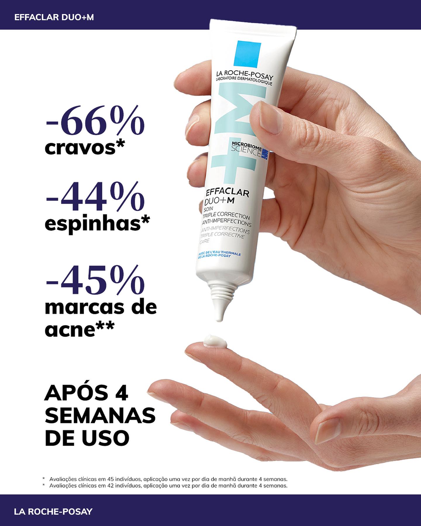 melhores hidratantes faciais para pele oleosa com acne