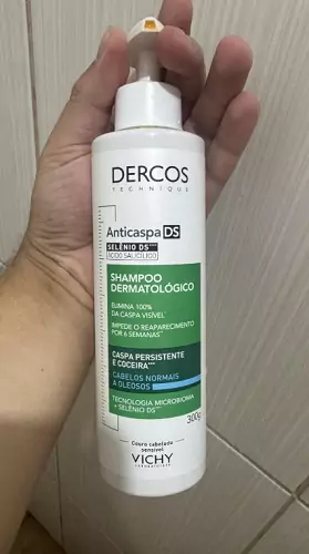shampoo anticaspa para dermatite seborreica