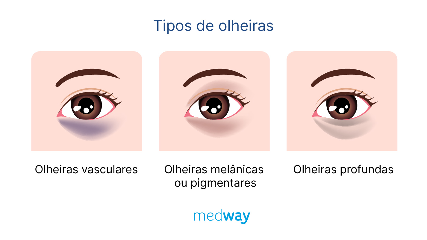 cafeína vitamina k olheiras