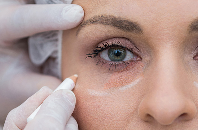 melhores tratamentos olheiras escuras