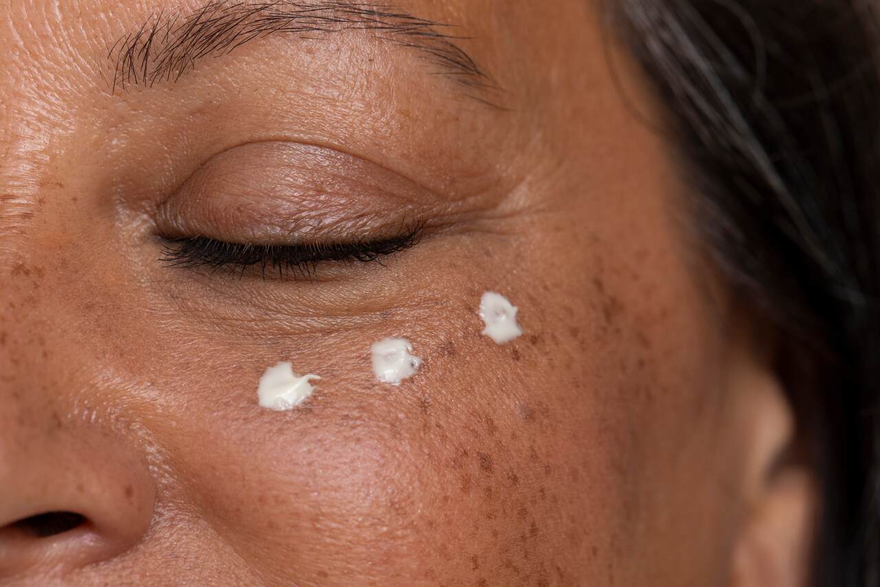 qual o melhor creme para área dos olhos