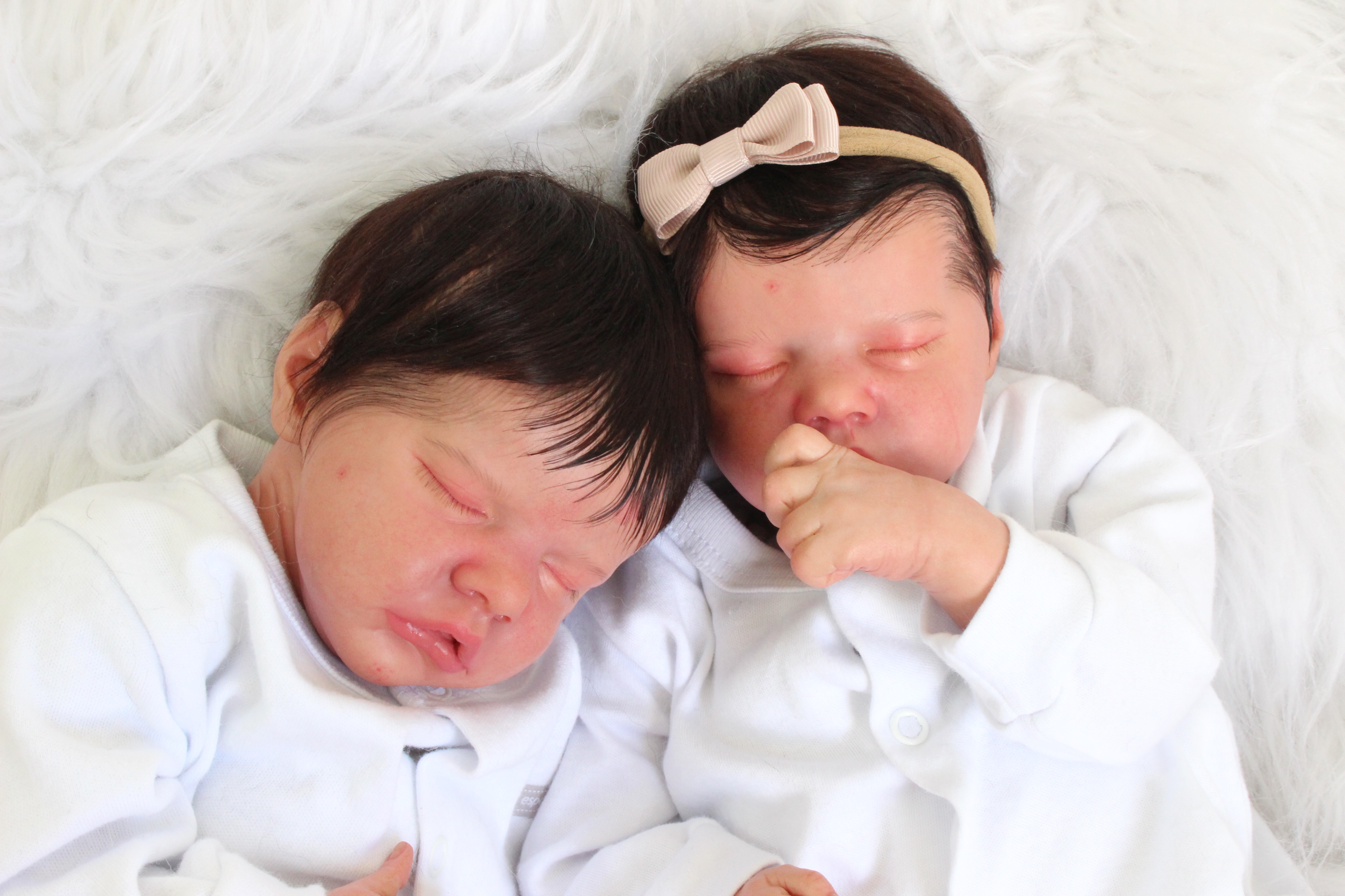 Manchas e Erupções no Rosto do Recém-Nascido: Quando se Preocupar?