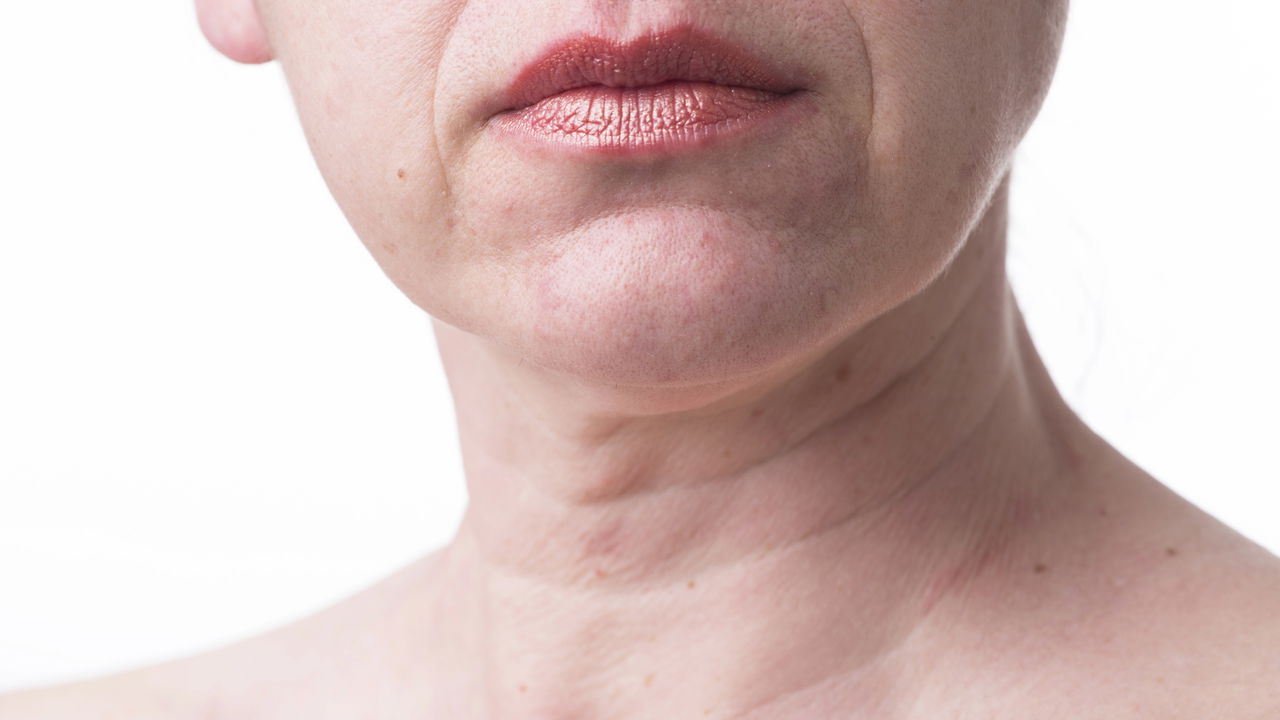 Skincare para pescoço: como evitar rugas precoces