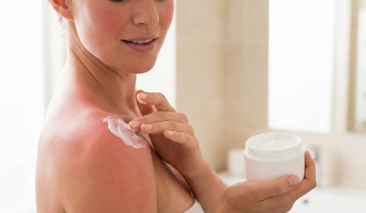 recuperação da pele após queimadura solar