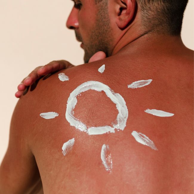 cuidados com a pele após exposição solar