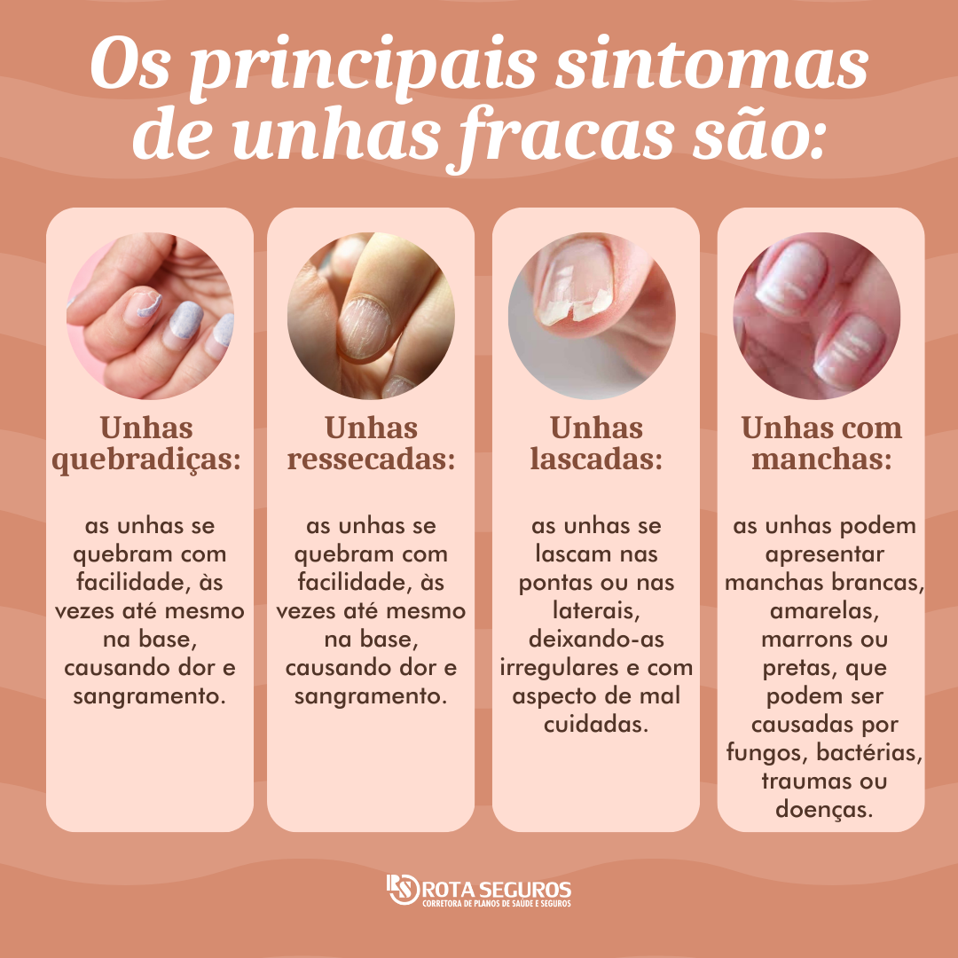 unhas descamando